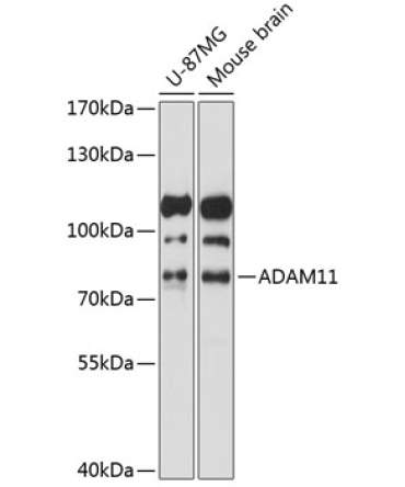 ADAM11 Rabbit Polyclonal Antibody