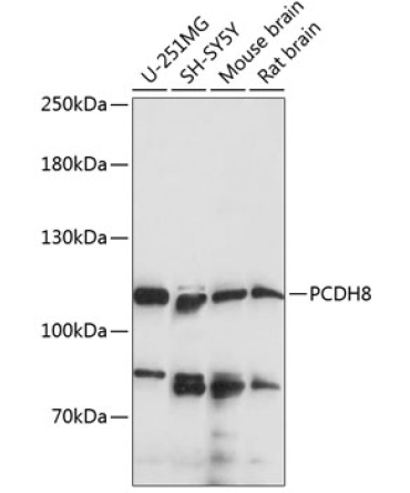 PCDH8 Rabbit Polyclonal Antibody