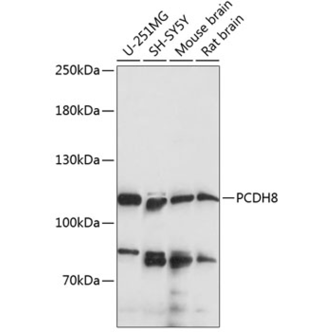 PCDH8 Rabbit Polyclonal Antibody