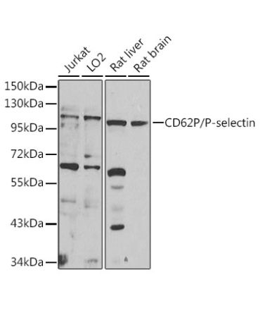 CD62P/P-selectin Rabbit Polyclonal Antibody