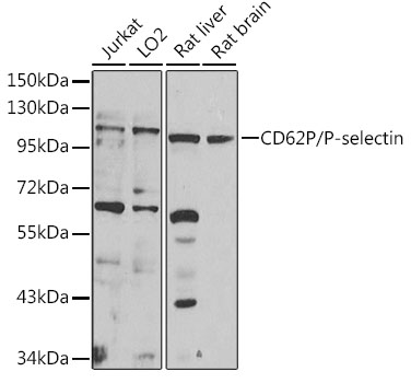 CD62P/P-selectin Rabbit Polyclonal Antibody