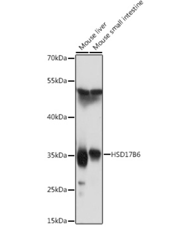 HSD17B6 Rabbit Polyclonal Antibody
