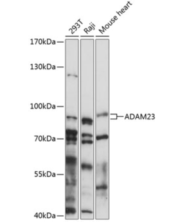 ADAM23 Rabbit Polyclonal Antibody
