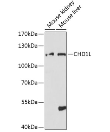 CHD1L Rabbit Polyclonal Antibody