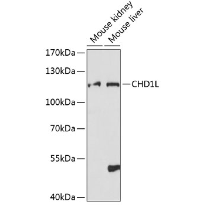 CHD1L Rabbit Polyclonal Antibody