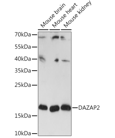 DAZAP2 Rabbit Polyclonal Antibody