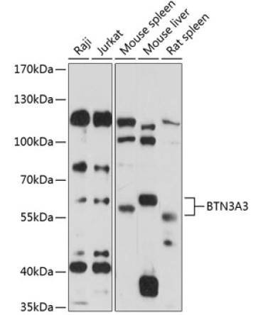BTN3A3 Rabbit Polyclonal Antibody