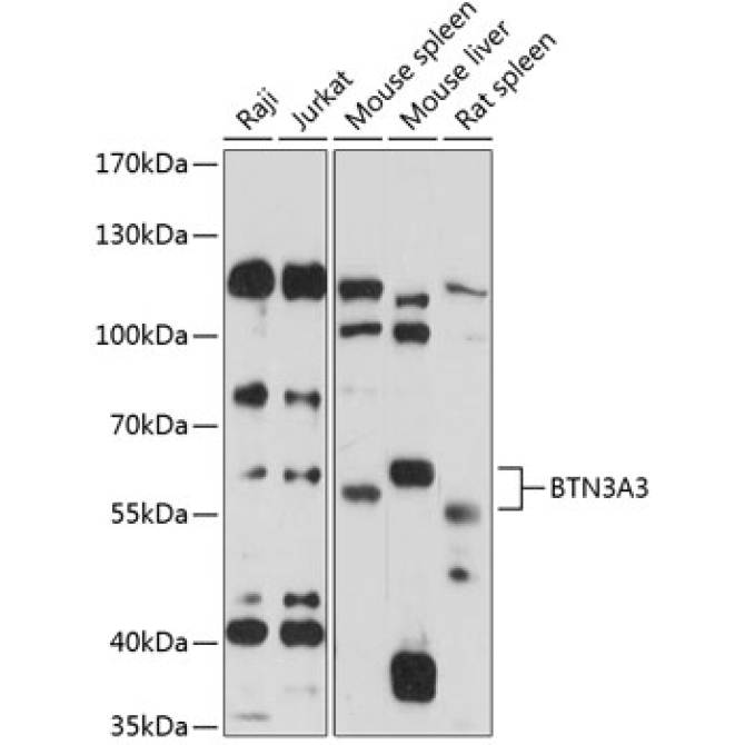 BTN3A3 Rabbit Polyclonal Antibody
