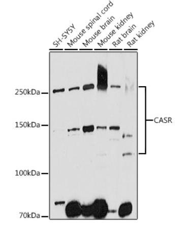 CASR Rabbit Polyclonal Antibody