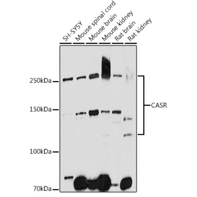 CASR Rabbit Polyclonal Antibody
