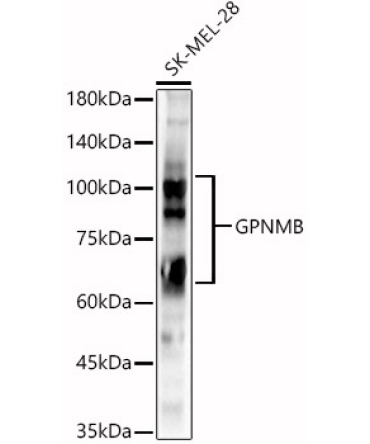 GPNMB Rabbit Polyclonal Antibody