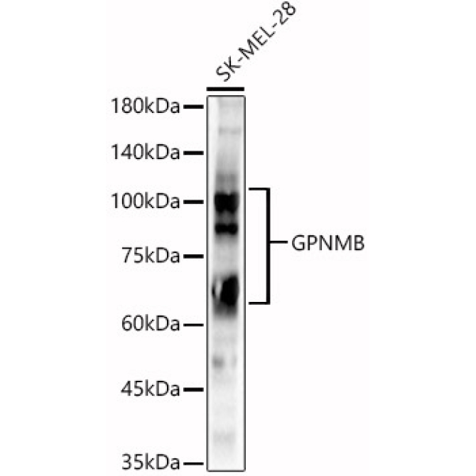 GPNMB Rabbit Polyclonal Antibody