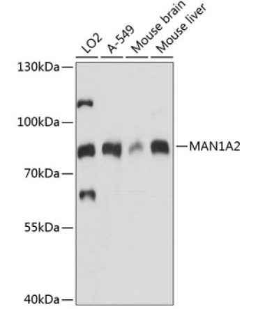 MAN1A2 Rabbit Polyclonal Antibody