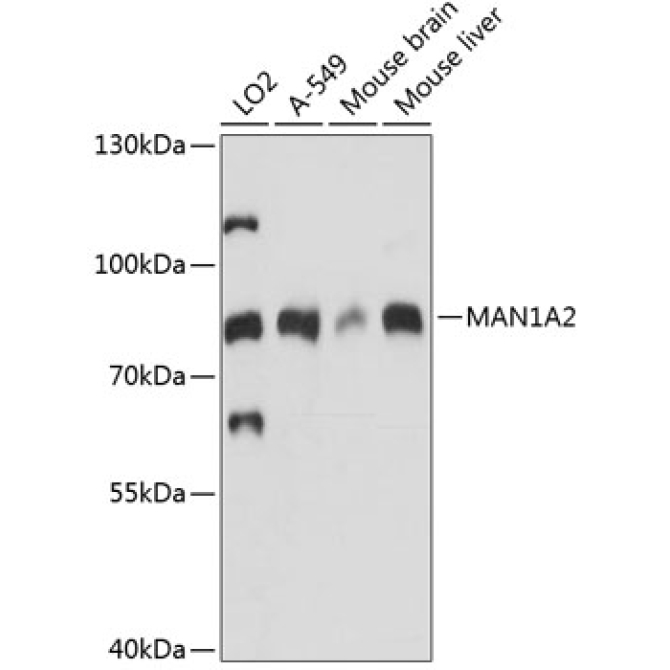 MAN1A2 Rabbit Polyclonal Antibody