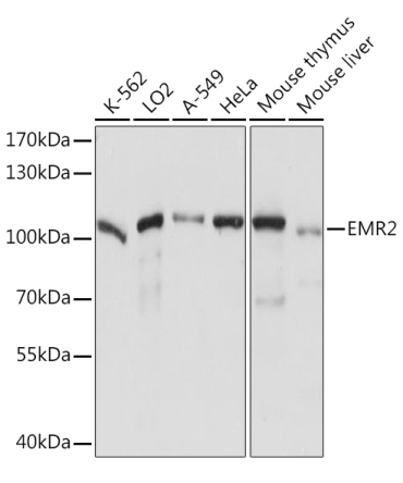EMR2 Rabbit Polyclonal Antibody