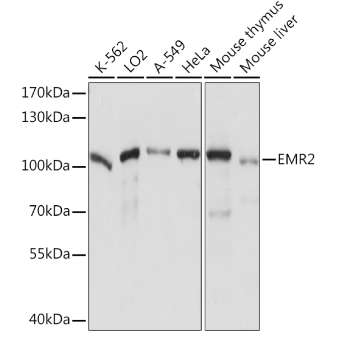 EMR2 Rabbit Polyclonal Antibody