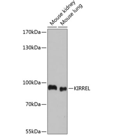 KIRREL Rabbit Polyclonal Antibody