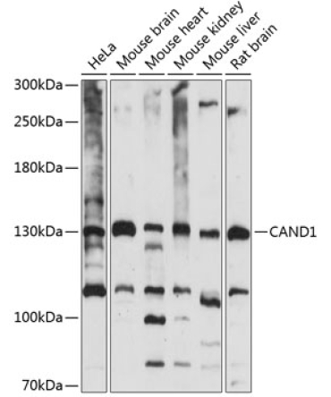 CAND1 Rabbit Polyclonal Antibody