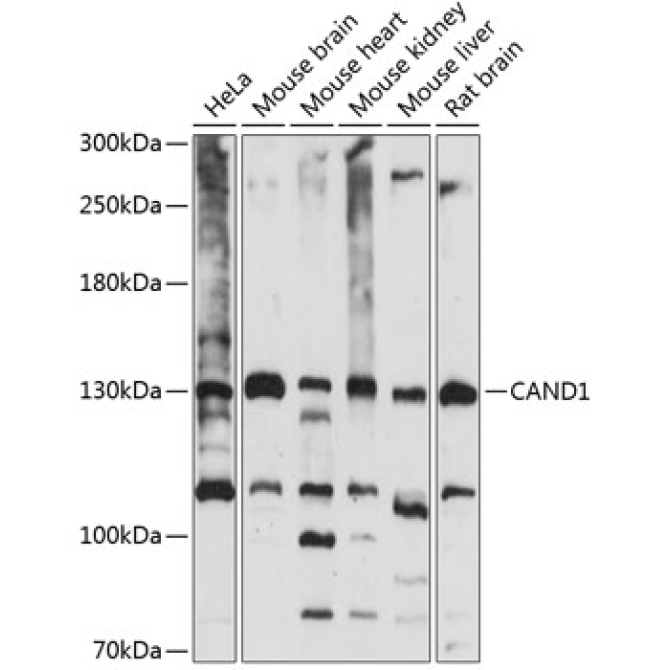 CAND1 Rabbit Polyclonal Antibody