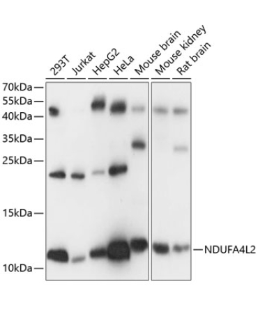 NDUFA4L2 Rabbit Polyclonal Antibody
