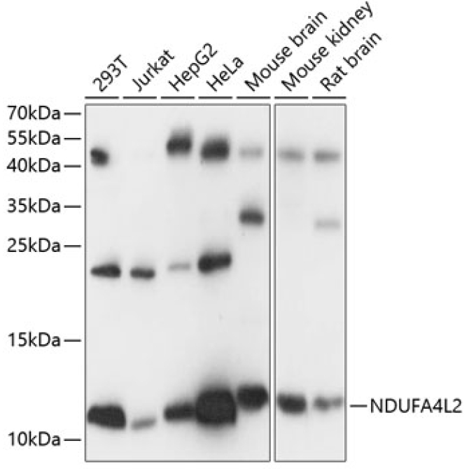NDUFA4L2 Rabbit Polyclonal Antibody