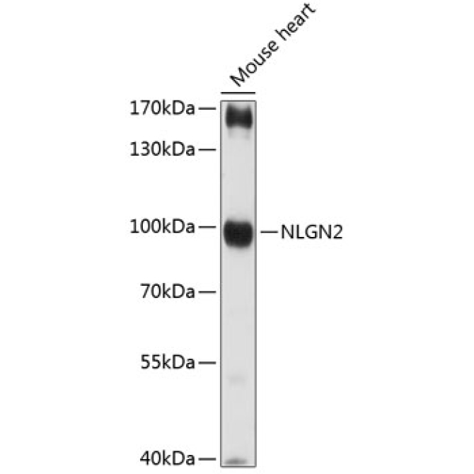 NLGN2 Rabbit Polyclonal Antibody