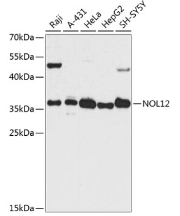 NOL12 Rabbit Polyclonal Antibody