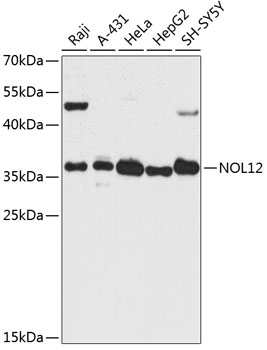 NOL12 Rabbit Polyclonal Antibody