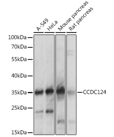 CCDC124 Rabbit Polyclonal Antibody