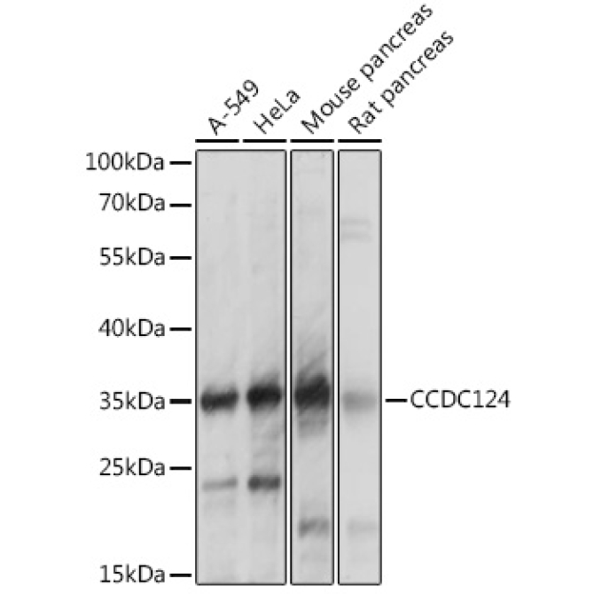 CCDC124 Rabbit Polyclonal Antibody