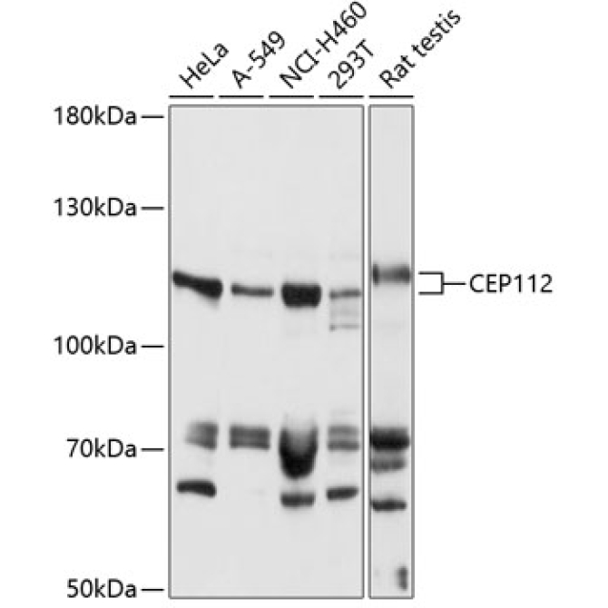 CEP112 Rabbit Polyclonal Antibody