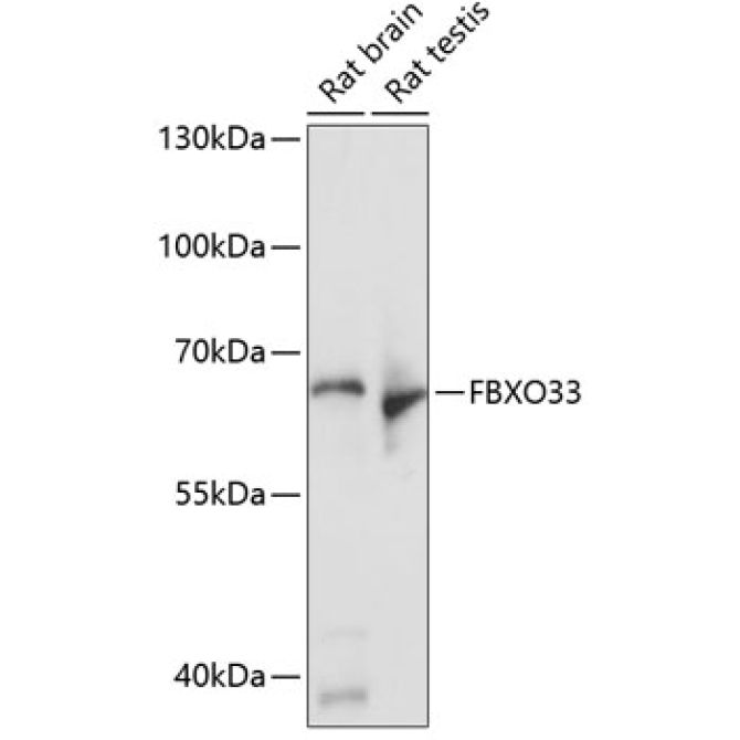 FBXO33 Rabbit Polyclonal Antibody