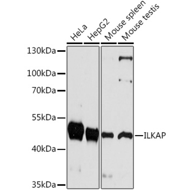 ILKAP Rabbit Polyclonal Antibody