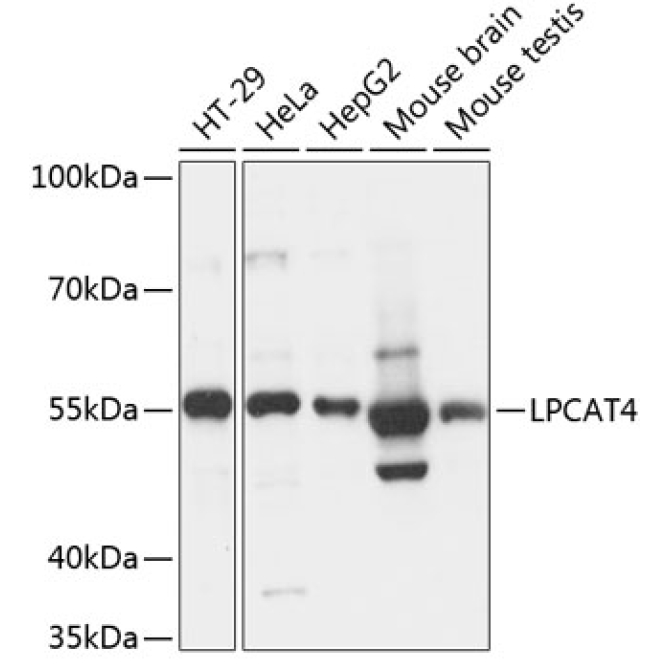 LPCAT4 Rabbit Polyclonal Antibody