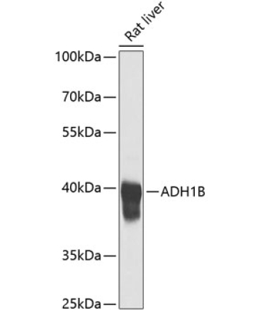 ADH1B Rabbit Polyclonal Antibody