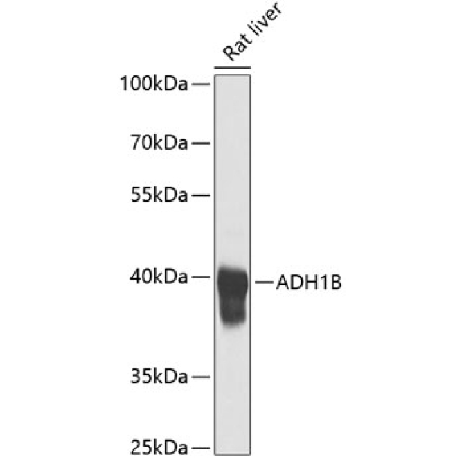 ADH1B Rabbit Polyclonal Antibody