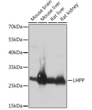 LHPP Rabbit Polyclonal Antibody
