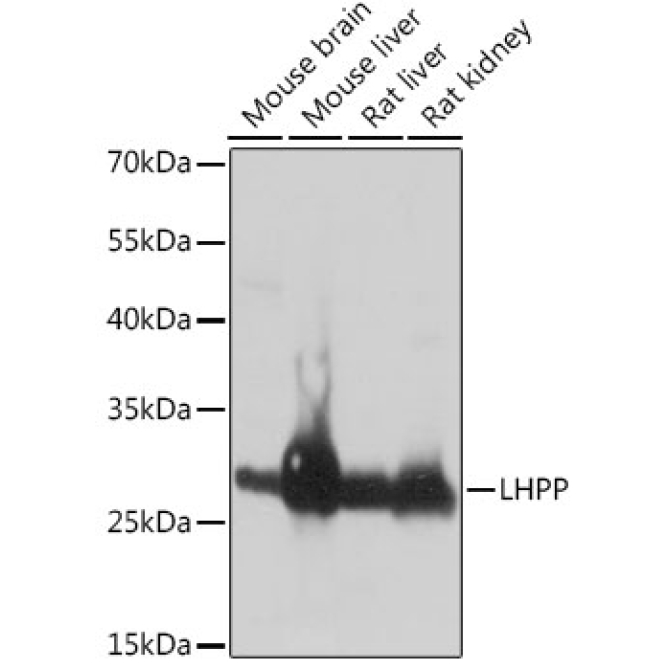 LHPP Rabbit Polyclonal Antibody