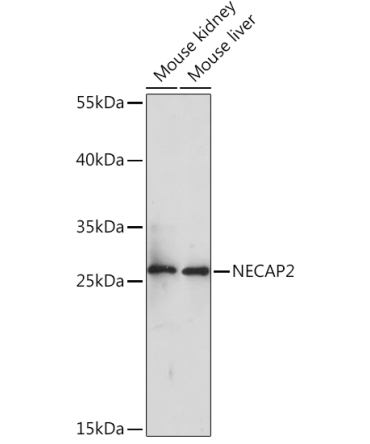 NECAP2 Rabbit Polyclonal Antibody