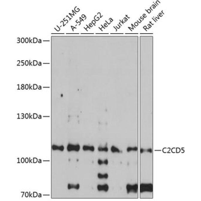 C2CD5 Rabbit Polyclonal Antibody