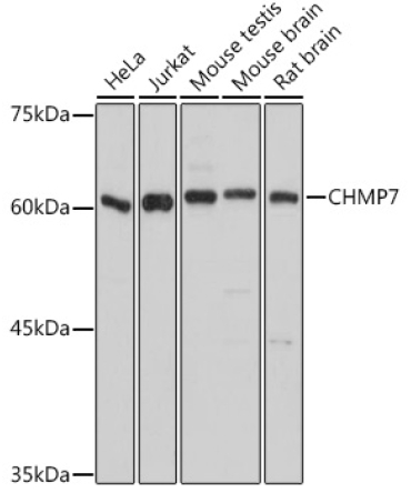 CHMP7 Rabbit Polyclonal Antibody