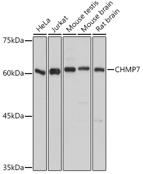 CHMP7 Rabbit Polyclonal Antibody