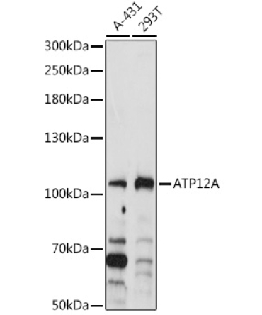 ATP12A Rabbit Polyclonal Antibody