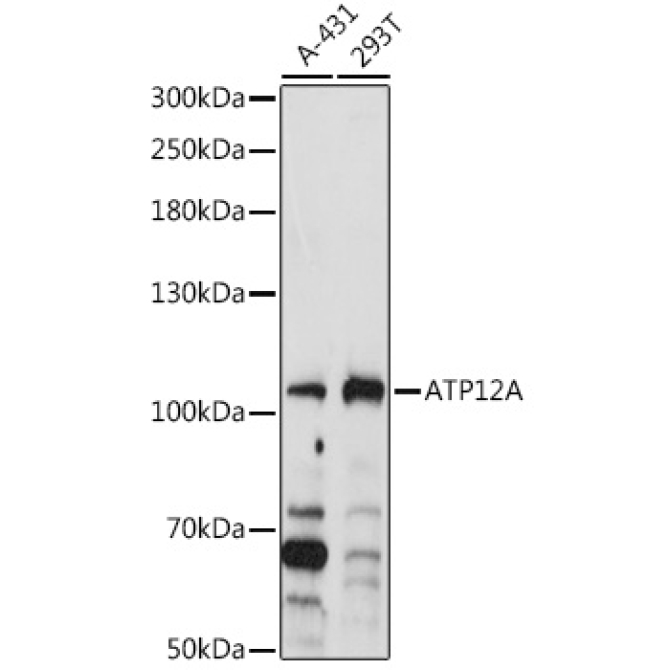 ATP12A Rabbit Polyclonal Antibody