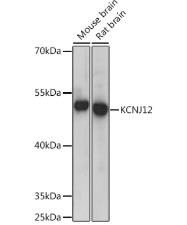 KCNJ12 Rabbit Polyclonal Antibody