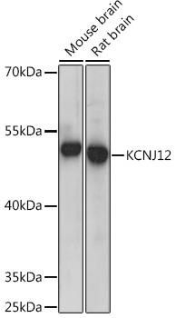 KCNJ12 Rabbit Polyclonal Antibody