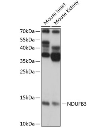NDUFB3 Rabbit Polyclonal Antibody