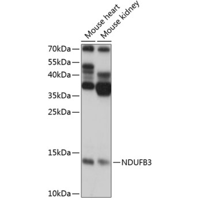 NDUFB3 Rabbit Polyclonal Antibody