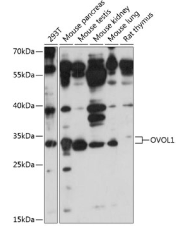 OVOL1 Rabbit Polyclonal Antibody