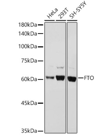 FTO Rabbit Polyclonal Antibody